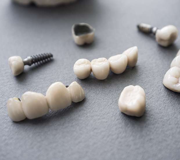 Irvine The Difference Between Dental Implants and Mini Dental Implants