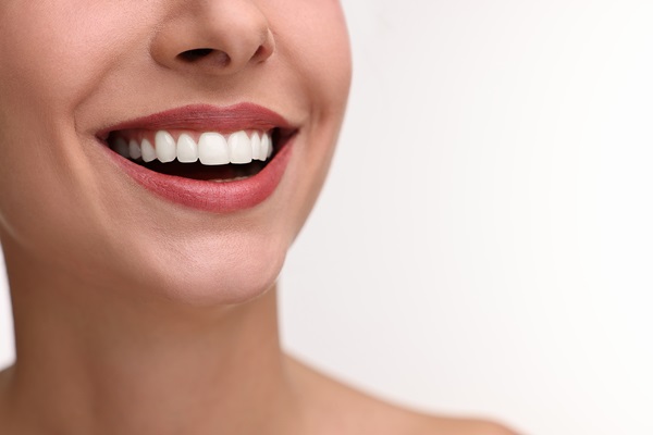 A Guide To Getting A Smile Makeover From A Dentist